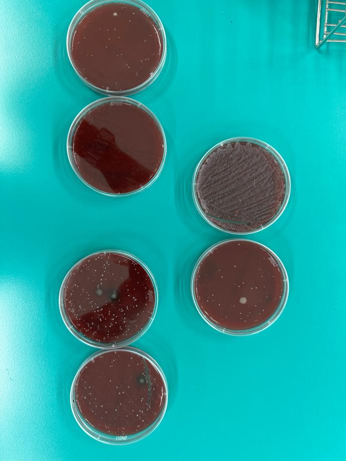 실험을 통해서 피부상재균 배양